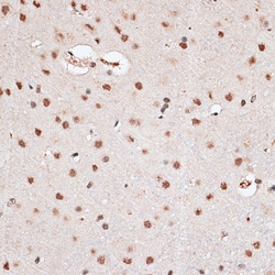 Invitrogen RBM3 Polyclonal Antibody 100 &mu;L; Unconjugated:Antibodies,