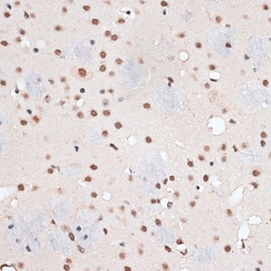 Invitrogen RBM3 Polyclonal Antibody 100 &mu;L; Unconjugated:Antibodies,