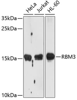 Invitrogen RBM3 Polyclonal Antibody 100 &mu;L; Unconjugated:Antibodies,
