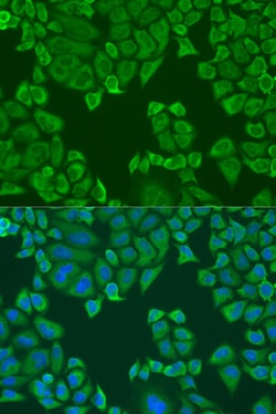 Invitrogen PABPC4 Polyclonal Antibody 100 &mu;L; Unconjugated:Antibodies,