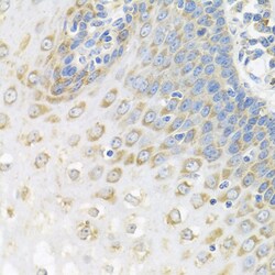 Invitrogen PABPC4 Polyclonal Antibody 100 &mu;L; Unconjugated:Antibodies,