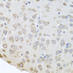 Invitrogen PABPC4 Polyclonal Antibody 100 &mu;L; Unconjugated:Antibodies,