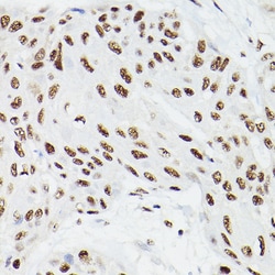 Invitrogen CPSF6 Polyclonal Antibody 100 &mu;L; Unconjugated:Antibodies,