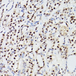 Invitrogen CPSF6 Polyclonal Antibody 100 &mu;L; Unconjugated:Antibodies,