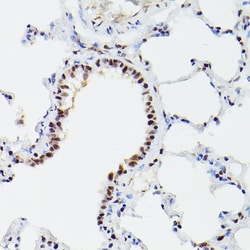 Invitrogen CPSF6 Polyclonal Antibody 100 &mu;L; Unconjugated:Antibodies,