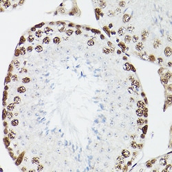 Invitrogen CPSF6 Polyclonal Antibody 100 &mu;L; Unconjugated:Antibodies,