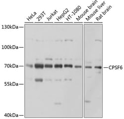 Invitrogen CPSF6 Polyclonal Antibody 100 &mu;L; Unconjugated:Antibodies,