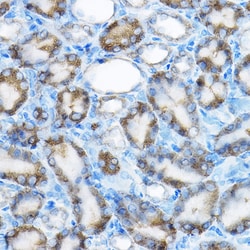Invitrogen MRPL13 Polyclonal Antibody 100 &mu;L; Unconjugated:Antibodies,
