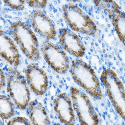 Invitrogen MRPL13 Polyclonal Antibody 100 &mu;L; Unconjugated:Antibodies,