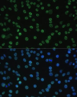 Invitrogen ALY Polyclonal Antibody 100 &mu;L; Unconjugated:Antibodies,