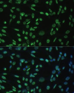 Invitrogen ALY Polyclonal Antibody 100 &mu;L; Unconjugated:Antibodies,