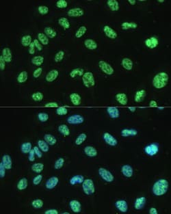 Invitrogen ALY Polyclonal Antibody 100 &mu;L; Unconjugated:Antibodies,
