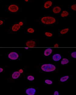 Invitrogen ALY Polyclonal Antibody 100 &mu;L; Unconjugated:Antibodies,