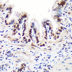Invitrogen ALY Polyclonal Antibody 100 &mu;L; Unconjugated:Antibodies,