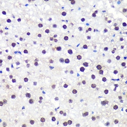 Invitrogen ALY Polyclonal Antibody 100 &mu;L; Unconjugated:Antibodies,