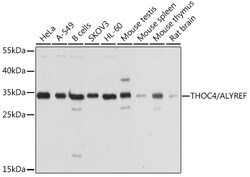 Invitrogen ALY Polyclonal Antibody 100 &mu;L; Unconjugated:Antibodies,