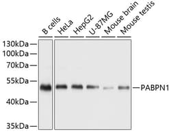 Invitrogen PABPN1 Polyclonal Antibody 100 &mu;L; Unconjugated:Antibodies,