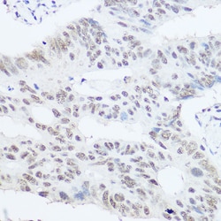 Invitrogen PRP8 Polyclonal Antibody 100 &mu;L; Unconjugated:Antibodies,