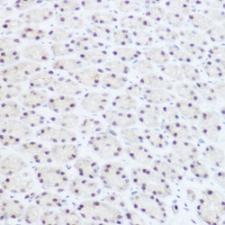 Invitrogen PRP8 Polyclonal Antibody 100 &mu;L; Unconjugated:Antibodies,