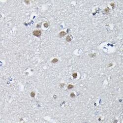 Invitrogen PTBP2 Polyclonal Antibody 100 &mu;L; Unconjugated:Antibodies,