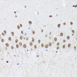Invitrogen PTBP2 Polyclonal Antibody 100 &mu;L; Unconjugated:Antibodies,
