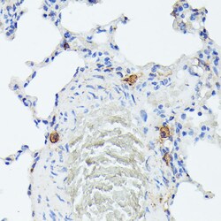 Invitrogen TIAL1 Polyclonal Antibody 100 &mu;L; Unconjugated:Antibodies,