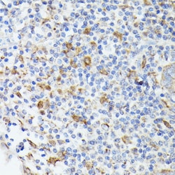 Invitrogen TIAL1 Polyclonal Antibody 100 &mu;L; Unconjugated:Antibodies,