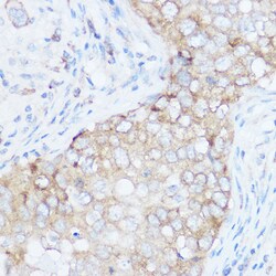 eIF4G Polyclonal Antibody, Invitrogen 100 &mu;L; Unconjugated:Antibodies,