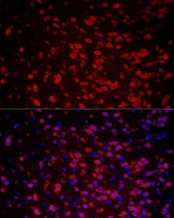 Invitrogen HuC Polyclonal Antibody 100 &mu;L; Unconjugated:Antibodies,