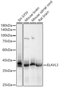 Invitrogen HuC Polyclonal Antibody 100 &mu;L; Unconjugated:Antibodies,