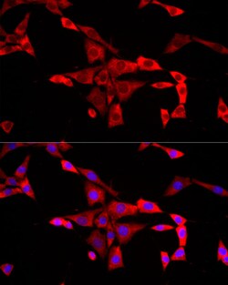 Invitrogen FMRP Polyclonal Antibody 100 &mu;L; Unconjugated:Antibodies,