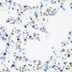 Invitrogen FMRP Polyclonal Antibody 100 &mu;L; Unconjugated:Antibodies,