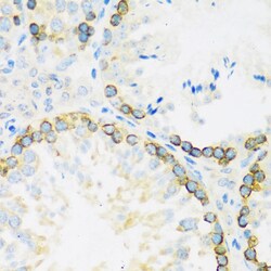 Invitrogen FMRP Polyclonal Antibody 100 &mu;L; Unconjugated:Antibodies,