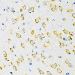 Invitrogen FMRP Polyclonal Antibody 100 &mu;L; Unconjugated:Antibodies,