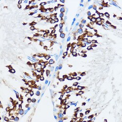Invitrogen IGF2BP3 Polyclonal Antibody 100 &mu;L; Unconjugated:Antibodies,