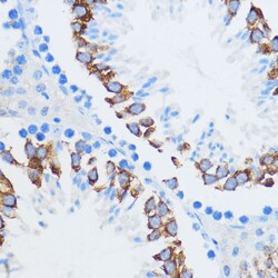 Invitrogen IGF2BP3 Polyclonal Antibody 100 &mu;L; Unconjugated:Antibodies,