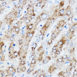 Invitrogen IGF2BP3 Polyclonal Antibody 100 &mu;L; Unconjugated:Antibodies,