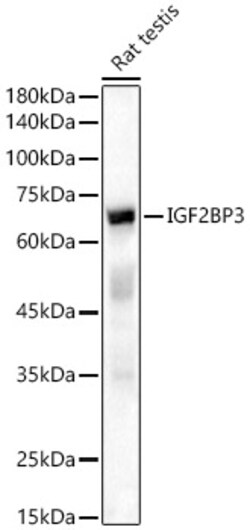 Invitrogen IGF2BP3 Polyclonal Antibody 100 &mu;L; Unconjugated:Antibodies,