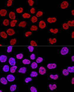 Invitrogen SAM68 Polyclonal Antibody 100 &mu;L | Buy Online | Invitrogen&trade; | Fisher Scientific