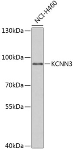 Invitrogen KCNN3 Polyclonal Antibody 100 &mu;L; Unconjugated:Antibodies,