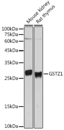 GSTZ1 Polyclonal Antibody:Antibodies, Polyclonal