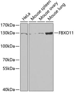 Invitrogen FBXO11 Polyclonal Antibody 100 &mu;L | Buy Online | Invitrogen&trade; | Fisher Scientific