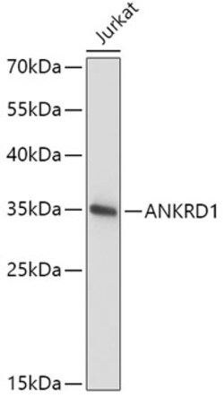 CARP Polyclonal Antibody:Antibodies, Polyclonal