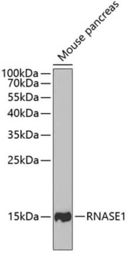 Invitrogen RNase1 Polyclonal Antibody 100 &mu;L; Unconjugated:Antibodies,