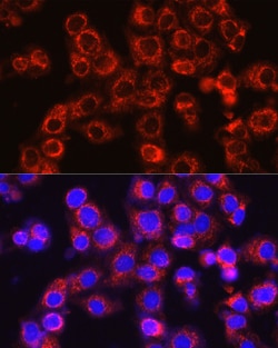 Invitrogen Osteocalcin Polyclonal Antibody 100 &mu;L; Unconjugated:Antibodies,