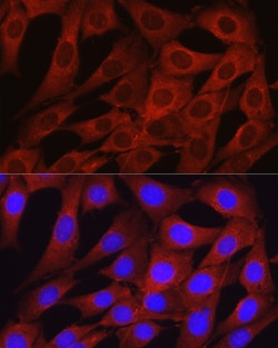 Invitrogen Osteocalcin Polyclonal Antibody 100 &mu;L; Unconjugated:Antibodies,