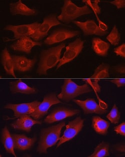 Invitrogen Osteocalcin Polyclonal Antibody 100 &mu;L; Unconjugated:Antibodies,