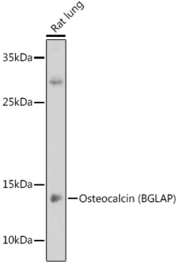 Invitrogen Osteocalcin Polyclonal Antibody 100 &mu;L; Unconjugated:Antibodies,