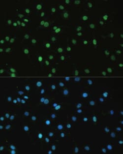 Invitrogen SET Polyclonal Antibody 100 &mu;L; Unconjugated:Antibodies,