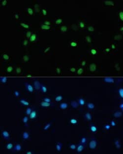 Invitrogen SET Polyclonal Antibody 100 &mu;L; Unconjugated:Antibodies,